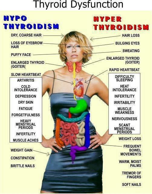 Thyroid Disfunction